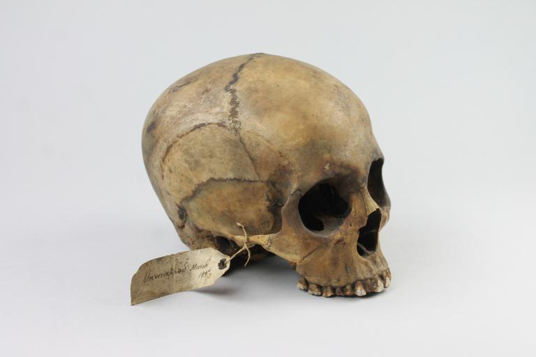 Human Remains; Cranium card