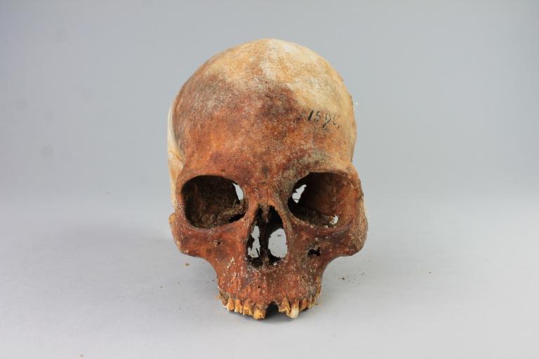 Human Remains; Skull card