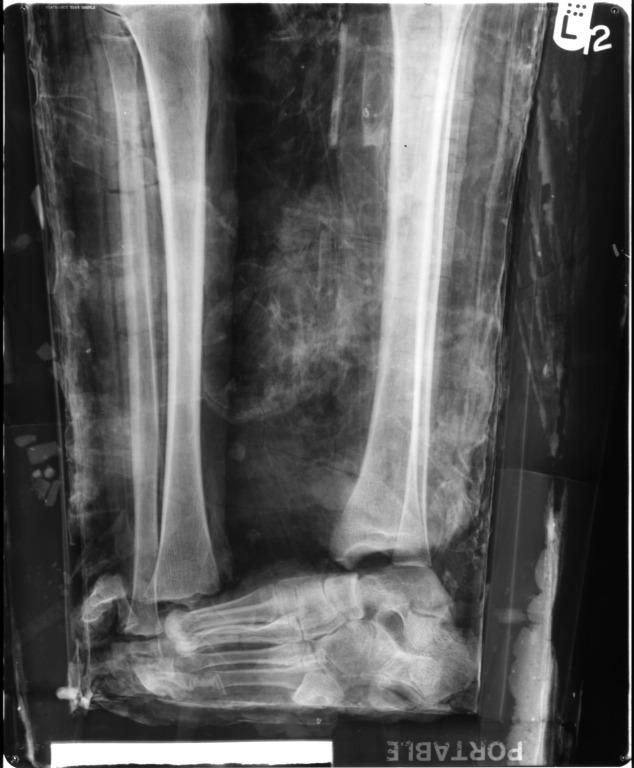 Human Remains; Mummified Body of Nesshutefnut card